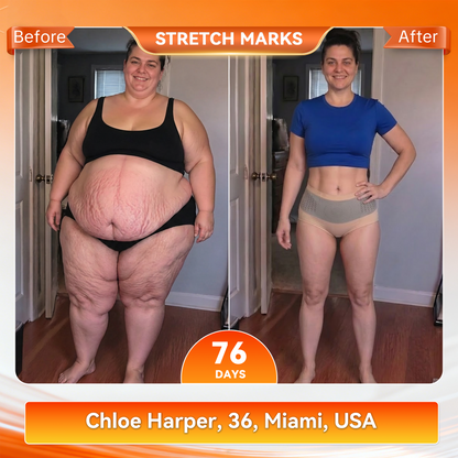 𝐎𝐟𝐟𝐢𝐜𝐢𝐚𝐥 𝐁𝐫𝐚𝐧𝐝 𝐒𝐭𝐨𝐫𝐞 | 🔷𝐏𝐀𝐔𝐑𝐀𝐉𝐔® 𝟐𝟎𝟐𝟔 𝐌𝐨𝐫𝐢𝐧𝐠𝐚 & 𝐁𝐞𝐫𝐛𝐞𝐫𝐢𝐧𝐞 𝟒-𝐈𝐧-𝟏 𝐌𝐢𝐜𝐫𝐨-𝐏𝐚𝐫𝐭𝐢𝐜𝐥𝐞 𝐒𝐜𝐮𝐥𝐩𝐭𝐢𝐧𝐠 & 𝐅𝐚𝐭-𝐁𝐮𝐫𝐧 𝐒𝐡𝐨𝐫𝐭𝐬⚜️(Women + Men with Enhanced Male Vitality Blend)