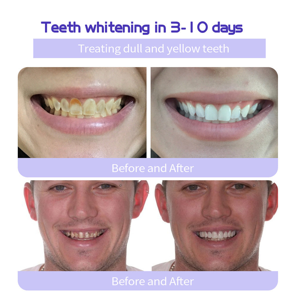 Oyikey® Teeth Restoration Mineral Powder👩‍⚕️Recommended by the dentisit🎉𝗟𝗶𝗺𝗶𝘁𝗲𝗱 𝘁𝗶𝗺𝗲 𝘀𝗽𝗲𝗰𝗶𝗮𝗹🔥