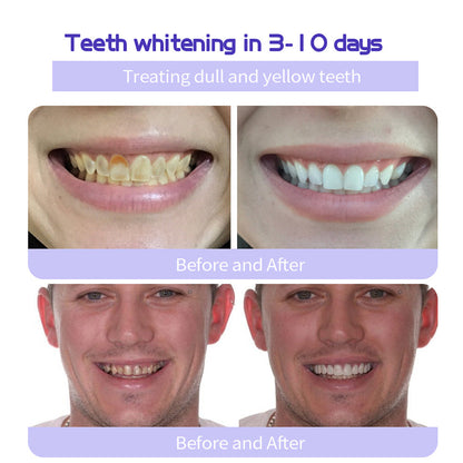 Oyikey® Teeth Restoration Mineral Powder👩‍⚕️Recommended by the dentisit🎉𝗟𝗶𝗺𝗶𝘁𝗲𝗱 𝘁𝗶𝗺𝗲 𝘀𝗽𝗲𝗰𝗶𝗮𝗹🔥