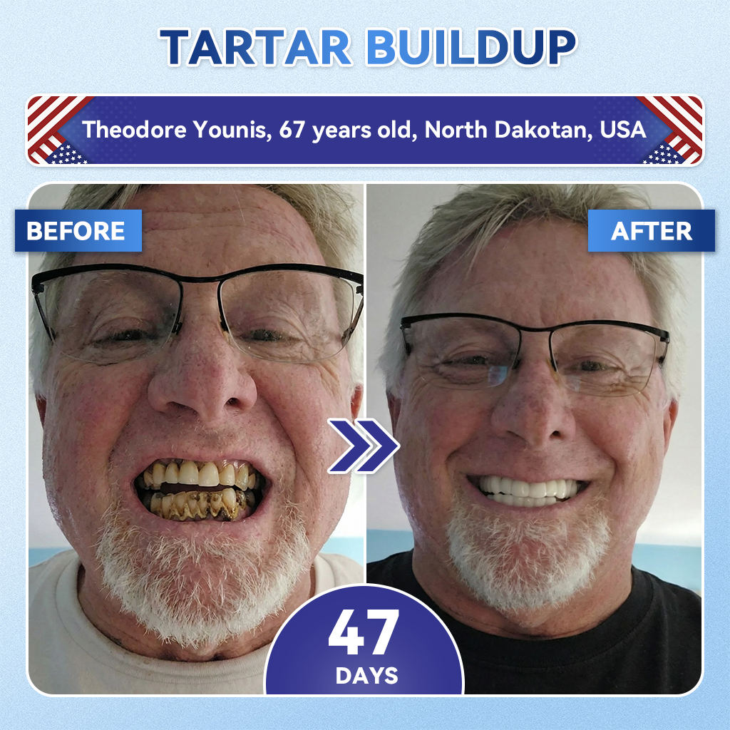 𝐆𝗹𝐢𝙢𝙢𝐞𝐫𝗹𝙮® 𝐓𝐢𝐝𝙚𝐠𝗜𝐮𝐬𝐢𝐛 𝐓𝐨𝐨𝐭𝐡 & 𝐆𝐮𝐦 𝐑𝐞𝐩𝐚𝐢𝐫 𝐌𝐢𝐜𝐫𝐨𝐧𝐞𝐞𝐝𝗜𝐞 𝐏𝐚𝐭𝐜𝐡 | 🦷𝐀𝐝𝐯𝐚𝐧𝐜𝐞𝐝 𝐒𝐭𝐞𝐦-𝐂𝐞𝐥𝐥 𝐀𝐜𝐭𝐢𝐯𝐚𝐭𝐢𝐨𝐧 𝐓𝐞𝐞𝐭𝐡 𝐒𝐭𝐫𝐢𝐩𝐬🆕(𝐑𝐞𝐛𝐮𝐢𝐥𝐝 𝐄𝐧𝐚𝐦𝐞𝐥 & 𝐃𝐞𝐧𝐭𝐢𝐧 • 𝐒𝐭𝐫𝐞𝐧𝐠𝐭𝐡𝐞𝐧 𝐆𝐮𝐦𝐬 • 𝐄𝐫𝐚𝐝𝐢𝐜𝐚𝐭𝐞 𝐓𝐚𝐫𝐭𝐚𝐫 & 𝐎𝐝𝐨𝐫 • 𝐒𝐭𝐨𝐩 𝐓𝐨𝐨𝐭𝐡 𝐒𝐞𝐧𝐬𝐢𝐭𝐢𝐯𝐢𝐭𝐲)