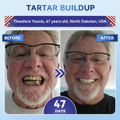 𝐆𝗹𝐢𝙢𝙢𝐞𝐫𝗹𝙮® 𝐓𝐢𝐝𝙚𝐠𝗜𝐮𝐬𝐢𝐛 𝐓𝐨𝐨𝐭𝐡 & 𝐆𝐮𝐦 𝐑𝐞𝐩𝐚𝐢𝐫 𝐌𝐢𝐜𝐫𝐨𝐧𝐞𝐞𝐝𝗜𝐞 𝐏𝐚𝐭𝐜𝐡 | 🦷𝐀𝐝𝐯𝐚𝐧𝐜𝐞𝐝 𝐒𝐭𝐞𝐦-𝐂𝐞𝐥𝐥 𝐀𝐜𝐭𝐢𝐯𝐚𝐭𝐢𝐨𝐧 𝐓𝐞𝐞𝐭𝐡 𝐒𝐭𝐫𝐢𝐩𝐬🆕(𝐑𝐞𝐛𝐮𝐢𝐥𝐝 𝐄𝐧𝐚𝐦𝐞𝐥 & 𝐃𝐞𝐧𝐭𝐢𝐧 • 𝐒𝐭𝐫𝐞𝐧𝐠𝐭𝐡𝐞𝐧 𝐆𝐮𝐦𝐬 • 𝐄𝐫𝐚𝐝𝐢𝐜𝐚𝐭𝐞 𝐓𝐚𝐫𝐭𝐚𝐫 & 𝐎𝐝𝐨𝐫 • 𝐒𝐭𝐨𝐩 𝐓𝐨𝐨𝐭𝐡 𝐒𝐞𝐧𝐬𝐢𝐭𝐢𝐯𝐢𝐭𝐲)