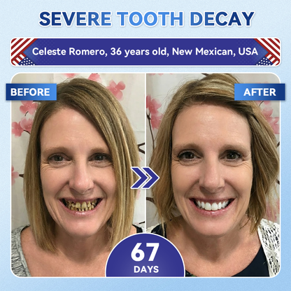 𝐆𝗹𝐢𝙢𝙢𝐞𝐫𝗹𝙮® 𝐓𝐢𝐝𝙚𝐠𝗜𝐮𝐬𝐢𝐛 𝐓𝐨𝐨𝐭𝐡 & 𝐆𝐮𝐦 𝐑𝐞𝐩𝐚𝐢𝐫 𝐌𝐢𝐜𝐫𝐨𝐧𝐞𝐞𝐝𝗜𝐞 𝐏𝐚𝐭𝐜𝐡 | 🦷𝐀𝐝𝐯𝐚𝐧𝐜𝐞𝐝 𝐒𝐭𝐞𝐦-𝐂𝐞𝐥𝐥 𝐀𝐜𝐭𝐢𝐯𝐚𝐭𝐢𝐨𝐧 𝐓𝐞𝐞𝐭𝐡 𝐒𝐭𝐫𝐢𝐩𝐬🆕(𝐑𝐞𝐛𝐮𝐢𝐥𝐝 𝐄𝐧𝐚𝐦𝐞𝐥 & 𝐃𝐞𝐧𝐭𝐢𝐧 • 𝐒𝐭𝐫𝐞𝐧𝐠𝐭𝐡𝐞𝐧 𝐆𝐮𝐦𝐬 • 𝐄𝐫𝐚𝐝𝐢𝐜𝐚𝐭𝐞 𝐓𝐚𝐫𝐭𝐚𝐫 & 𝐎𝐝𝐨𝐫 • 𝐒𝐭𝐨𝐩 𝐓𝐨𝐨𝐭𝐡 𝐒𝐞𝐧𝐬𝐢𝐭𝐢𝐯𝐢𝐭𝐲)