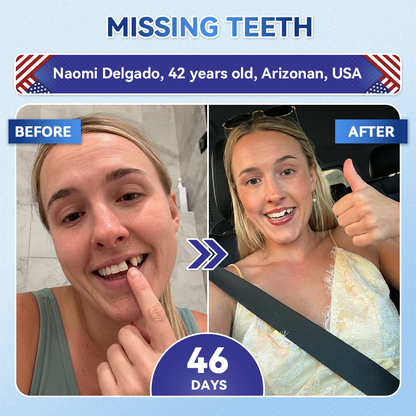 𝐆𝗹𝐢𝙢𝙢𝐞𝐫𝗹𝙮® 𝐓𝐢𝐝𝙚𝐠𝗜𝐮𝐬𝐢𝐛 𝐓𝐨𝐨𝐭𝐡 & 𝐆𝐮𝐦 𝐑𝐞𝐩𝐚𝐢𝐫 𝐌𝐢𝐜𝐫𝐨𝐧𝐞𝐞𝐝𝗜𝐞 𝐏𝐚𝐭𝐜𝐡 | 🦷𝐀𝐝𝐯𝐚𝐧𝐜𝐞𝐝 𝐒𝐭𝐞𝐦-𝐂𝐞𝐥𝐥 𝐀𝐜𝐭𝐢𝐯𝐚𝐭𝐢𝐨𝐧 𝐓𝐞𝐞𝐭𝐡 𝐒𝐭𝐫𝐢𝐩𝐬🆕(𝐑𝐞𝐛𝐮𝐢𝐥𝐝 𝐄𝐧𝐚𝐦𝐞𝐥 & 𝐃𝐞𝐧𝐭𝐢𝐧 • 𝐒𝐭𝐫𝐞𝐧𝐠𝐭𝐡𝐞𝐧 𝐆𝐮𝐦𝐬 • 𝐄𝐫𝐚𝐝𝐢𝐜𝐚𝐭𝐞 𝐓𝐚𝐫𝐭𝐚𝐫 & 𝐎𝐝𝐨𝐫 • 𝐒𝐭𝐨𝐩 𝐓𝐨𝐨𝐭𝐡 𝐒𝐞𝐧𝐬𝐢𝐭𝐢𝐯𝐢𝐭𝐲)