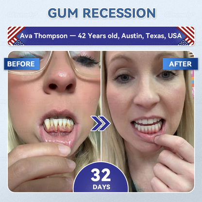 𝐆𝐥𝐢𝐦𝐦𝐞𝐫𝐥𝐲® 𝐓𝐢𝐝𝐞𝐠𝐥𝐮𝐬𝐢𝐛 𝐓𝐨𝐨𝐭𝐡 & 𝐆𝐮𝐦 𝐑𝐞𝐩𝐚𝐢𝐫 𝐌𝐢𝐜𝐫𝐨𝐧𝐞𝐞𝐝𝐥𝐞 𝐏𝐚𝐭𝐜𝐡👩‍⚕️ | 𝐀𝐝𝐯𝐚𝐧𝐜𝐞𝐝 𝐒𝐭𝐞𝐦-𝐂𝐞𝐥𝐥 𝐀𝐜𝐭𝐢𝐯𝐚𝐭𝐢𝐨𝐧 𝐓𝐞𝐞𝐭𝐡 𝐒𝐭𝐫𝐢𝐩𝐬(🦷𝐑𝐞𝐛𝐮𝐢𝐥𝐝 𝐄𝐧𝐚𝐦𝐞𝐥 & 𝐃𝐞𝐧𝐭𝐢𝐧 • 𝐒𝐭𝐫𝐞𝐧𝐠𝐭𝐡𝐞𝐧 𝐆𝐮𝐦𝐬 • 𝐄𝐫𝐚𝐝𝐢𝐜𝐚𝐭𝐞 𝐓𝐚𝐫𝐭𝐚𝐫 & 𝐎𝐝𝐨𝐫 • 𝐒𝐭𝐨𝐩 𝐓𝐨𝐨𝐭𝐡 𝐒𝐞𝐧𝐬𝐢𝐭𝐢𝐯𝐢𝐭𝐲)🪴
