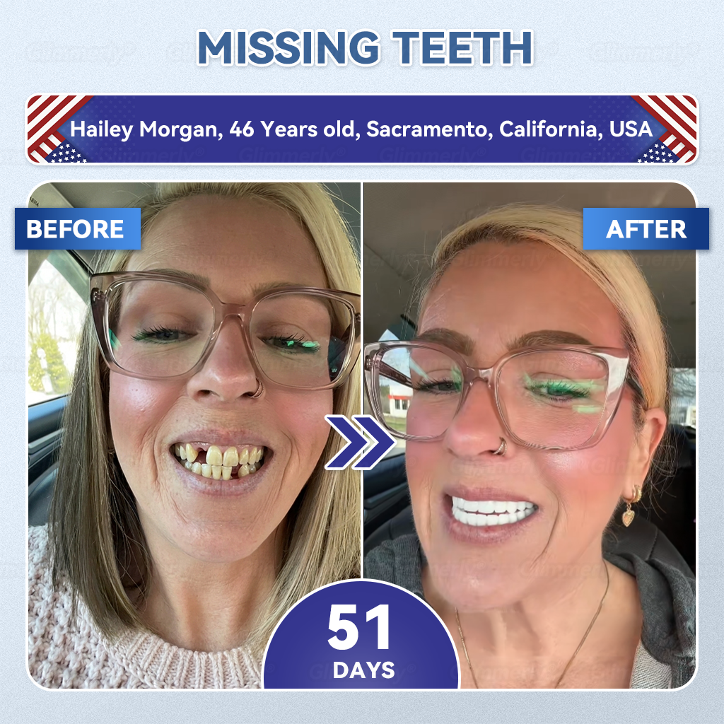 𝐆𝐥𝐢𝐦𝐦𝐞𝐫𝐥𝐲® 𝐓𝐢𝐝𝐞𝐠𝐥𝐮𝐬𝐢𝐛 𝐓𝐨𝐨𝐭𝐡 & 𝐆𝐮𝐦 𝐑𝐞𝐩𝐚𝐢𝐫 𝐌𝐢𝐜𝐫𝐨𝐧𝐞𝐞𝐝𝐥𝐞 𝐏𝐚𝐭𝐜𝐡👩‍⚕️ | 𝐀𝐝𝐯𝐚𝐧𝐜𝐞𝐝 𝐒𝐭𝐞𝐦-𝐂𝐞𝐥𝐥 𝐀𝐜𝐭𝐢𝐯𝐚𝐭𝐢𝐨𝐧 𝐓𝐞𝐞𝐭𝐡 𝐒𝐭𝐫𝐢𝐩𝐬(🦷𝐑𝐞𝐛𝐮𝐢𝐥𝐝 𝐄𝐧𝐚𝐦𝐞𝐥 & 𝐃𝐞𝐧𝐭𝐢𝐧 • 𝐒𝐭𝐫𝐞𝐧𝐠𝐭𝐡𝐞𝐧 𝐆𝐮𝐦𝐬 • 𝐄𝐫𝐚𝐝𝐢𝐜𝐚𝐭𝐞 𝐓𝐚𝐫𝐭𝐚𝐫 & 𝐎𝐝𝐨𝐫 • 𝐒𝐭𝐨𝐩 𝐓𝐨𝐨𝐭𝐡 𝐒𝐞𝐧𝐬𝐢𝐭𝐢𝐯𝐢𝐭𝐲)🪴