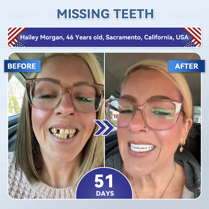𝐆𝐥𝐢𝐦𝐦𝐞𝐫𝐥𝐲® 𝐓𝐢𝐝𝐞𝐠𝐥𝐮𝐬𝐢𝐛 𝐓𝐨𝐨𝐭𝐡 & 𝐆𝐮𝐦 𝐑𝐞𝐩𝐚𝐢𝐫 𝐌𝐢𝐜𝐫𝐨𝐧𝐞𝐞𝐝𝐥𝐞 𝐏𝐚𝐭𝐜𝐡👩‍⚕️ | 𝐀𝐝𝐯𝐚𝐧𝐜𝐞𝐝 𝐒𝐭𝐞𝐦-𝐂𝐞𝐥𝐥 𝐀𝐜𝐭𝐢𝐯𝐚𝐭𝐢𝐨𝐧 𝐓𝐞𝐞𝐭𝐡 𝐒𝐭𝐫𝐢𝐩𝐬(🦷𝐑𝐞𝐛𝐮𝐢𝐥𝐝 𝐄𝐧𝐚𝐦𝐞𝐥 & 𝐃𝐞𝐧𝐭𝐢𝐧 • 𝐒𝐭𝐫𝐞𝐧𝐠𝐭𝐡𝐞𝐧 𝐆𝐮𝐦𝐬 • 𝐄𝐫𝐚𝐝𝐢𝐜𝐚𝐭𝐞 𝐓𝐚𝐫𝐭𝐚𝐫 & 𝐎𝐝𝐨𝐫 • 𝐒𝐭𝐨𝐩 𝐓𝐨𝐨𝐭𝐡 𝐒𝐞𝐧𝐬𝐢𝐭𝐢𝐯𝐢𝐭𝐲)🪴