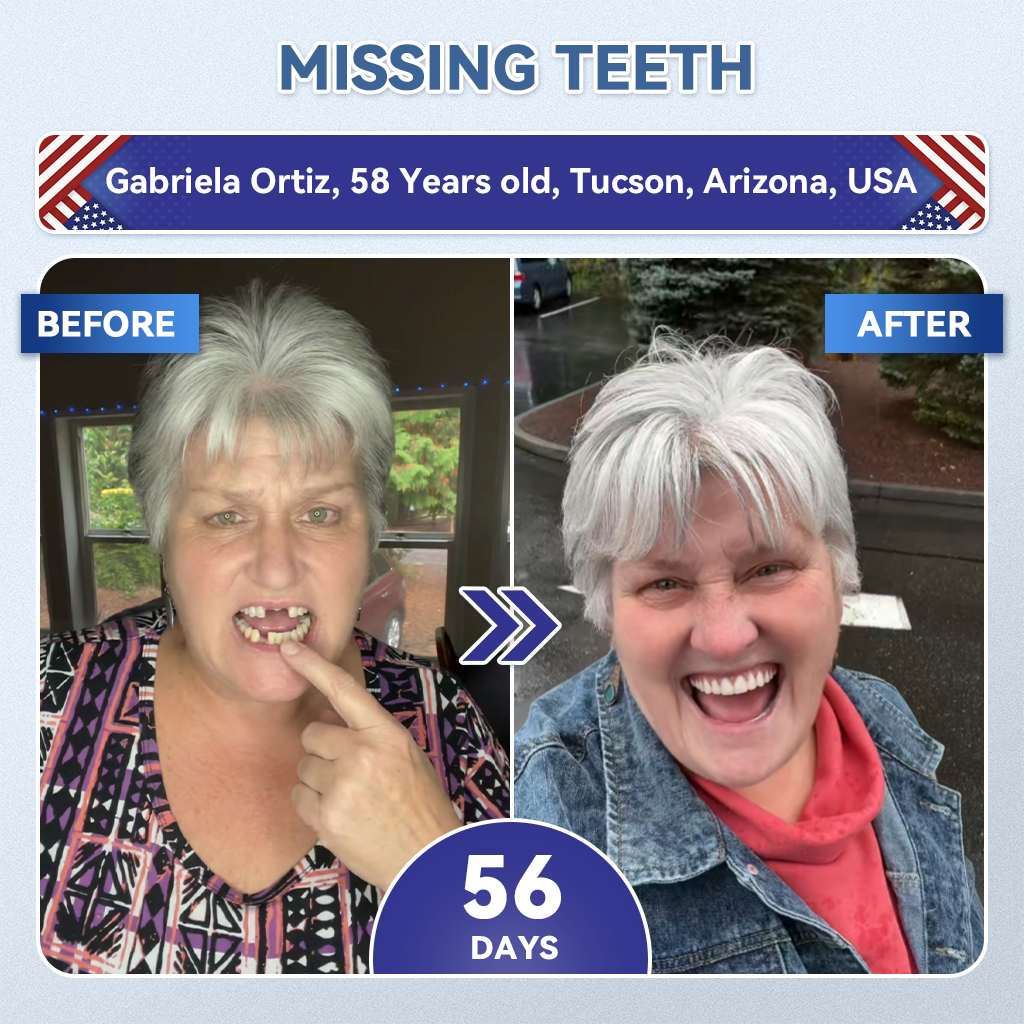 𝐆𝐥𝐢𝐦𝐦𝐞𝐫𝐥𝐲® 𝐓𝐢𝐝𝐞𝐠𝐥𝐮𝐬𝐢𝐛 𝐓𝐨𝐨𝐭𝐡 & 𝐆𝐮𝐦 𝐑𝐞𝐩𝐚𝐢𝐫 𝐌𝐢𝐜𝐫𝐨𝐧𝐞𝐞𝐝𝐥𝐞 𝐏𝐚𝐭𝐜𝐡👩‍⚕️ | 𝐀𝐝𝐯𝐚𝐧𝐜𝐞𝐝 𝐒𝐭𝐞𝐦-𝐂𝐞𝐥𝐥 𝐀𝐜𝐭𝐢𝐯𝐚𝐭𝐢𝐨𝐧 𝐓𝐞𝐞𝐭𝐡 𝐒𝐭𝐫𝐢𝐩𝐬(🦷𝐑𝐞𝐛𝐮𝐢𝐥𝐝 𝐄𝐧𝐚𝐦𝐞𝐥 & 𝐃𝐞𝐧𝐭𝐢𝐧 • 𝐒𝐭𝐫𝐞𝐧𝐠𝐭𝐡𝐞𝐧 𝐆𝐮𝐦𝐬 • 𝐄𝐫𝐚𝐝𝐢𝐜𝐚𝐭𝐞 𝐓𝐚𝐫𝐭𝐚𝐫 & 𝐎𝐝𝐨𝐫 • 𝐒𝐭𝐨𝐩 𝐓𝐨𝐨𝐭𝐡 𝐒𝐞𝐧𝐬𝐢𝐭𝐢𝐯𝐢𝐭𝐲)🪴