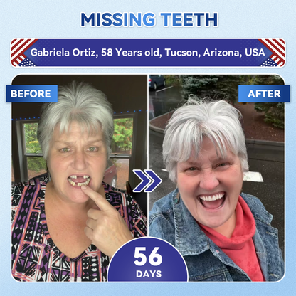𝐆𝐥𝐢𝐦𝐦𝐞𝐫𝐥𝐲® 🦷𝐓𝐢𝐝𝐞𝐠𝐥𝐮𝐬𝐢𝐛 𝐓𝐨𝐨𝐭𝐡 & 𝐆𝐮𝐦 𝐑𝐞𝐩𝐚𝐢𝐫 𝐌𝐢𝐜𝐫𝐨𝐧𝐞𝐞𝐝𝐥𝐞 𝐏𝐚𝐭𝐜𝐡  | 𝐀𝐝𝐯𝐚𝐧𝐜𝐞𝐝 𝐒𝐭𝐞𝐦-𝐂𝐞𝐥𝐥 𝐀𝐜𝐭𝐢𝐯𝐚𝐭𝐢𝐨𝐧 𝐓𝐞𝐞𝐭𝐡 𝐒𝐭𝐫𝐢𝐩𝐬(𝐑𝐞𝐛𝐮𝐢𝐥𝐝 𝐄𝐧𝐚𝐦𝐞𝐥 & 𝐃𝐞𝐧𝐭𝐢𝐧 • 𝐒𝐭𝐫𝐞𝐧𝐠𝐭𝐡𝐞𝐧 𝐆𝐮𝐦𝐬 • 𝐄𝐫𝐚𝐝𝐢𝐜𝐚𝐭𝐞 𝐓𝐚𝐫𝐭𝐚𝐫 & 𝐎𝐝𝐨𝐫 • 𝐒𝐭𝐨𝐩 𝐓𝐨𝐨𝐭𝐡 𝐒𝐞𝐧𝐬𝐢𝐭𝐢𝐯𝐢𝐭𝐲)🌺