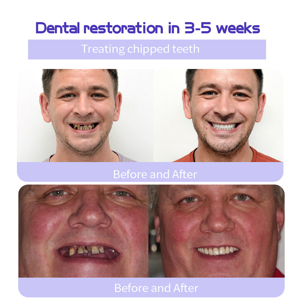 Oyikey® Teeth Restoration Mineral Powder👩‍⚕️Recommended by the dentisit🎉𝗟𝗶𝗺𝗶𝘁𝗲𝗱 𝘁𝗶𝗺𝗲 𝘀𝗽𝗲𝗰𝗶𝗮𝗹🔥