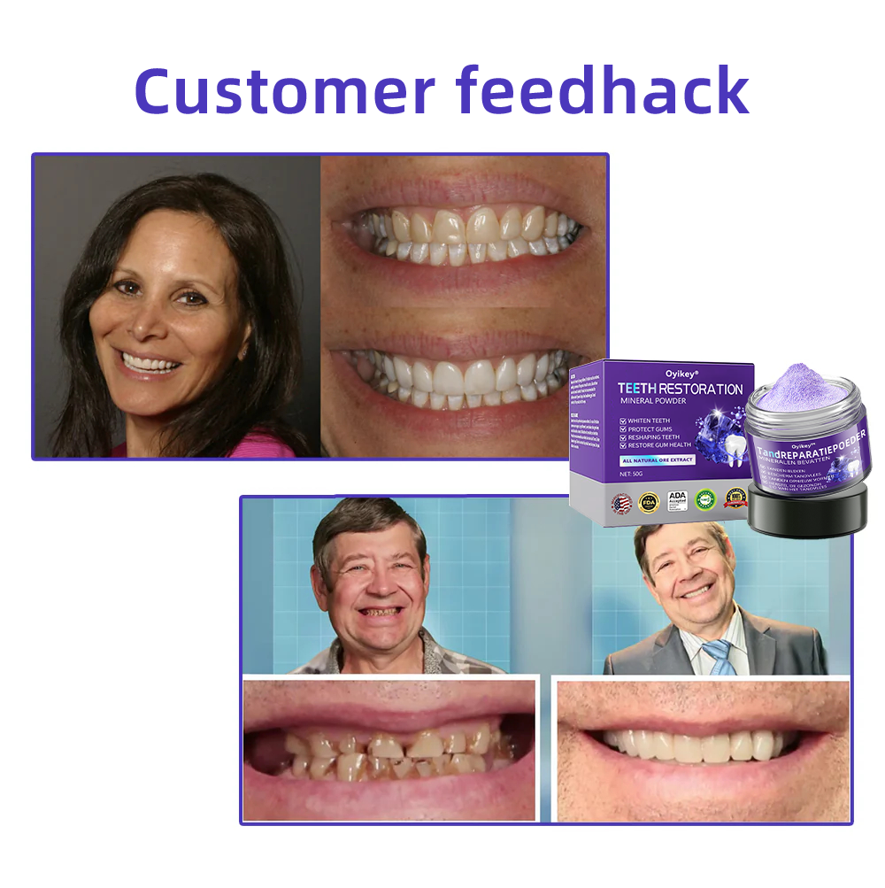 Oyikey® Teeth Restoration Mineral Powder👩‍⚕️Recommended by the dentisit🎉𝗟𝗶𝗺𝗶𝘁𝗲𝗱 𝘁𝗶𝗺𝗲 𝘀𝗽𝗲𝗰𝗶𝗮𝗹🔥