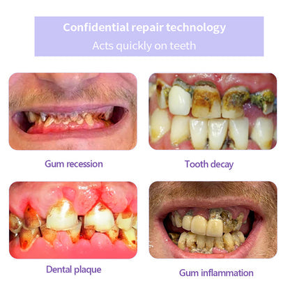 Oyikey® Teeth Restoration Mineral Powder👩‍⚕️Recommended by the dentisit🎉𝗟𝗶𝗺𝗶𝘁𝗲𝗱 𝘁𝗶𝗺𝗲 𝘀𝗽𝗲𝗰𝗶𝗮𝗹🔥